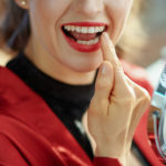 Dental-Bonding-zaehne