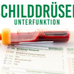 schilddruesenunterfunktion