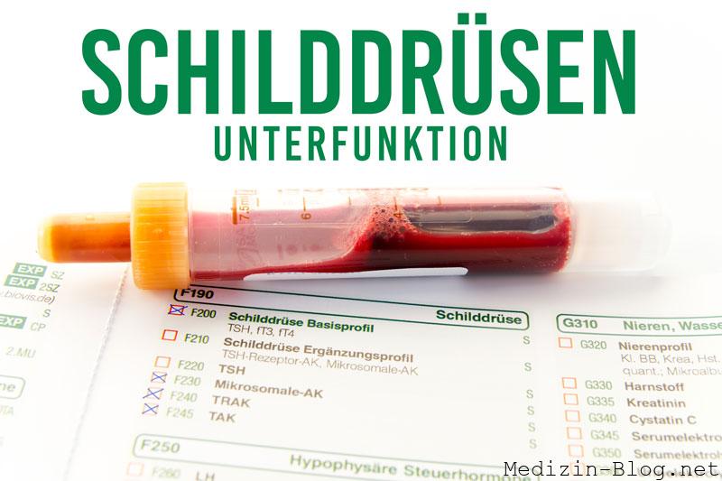 schilddruesenunterfunktion