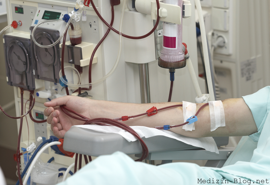 Dialyse bei Nierenversagen