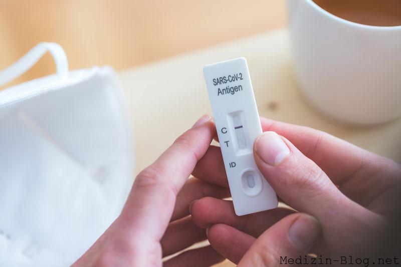 Antikoerpertest-covid-19
