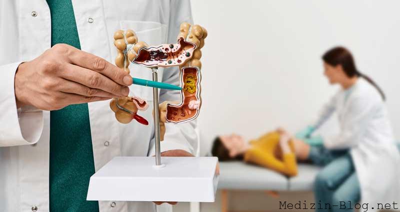 Morbus-Crohn-erkrankung