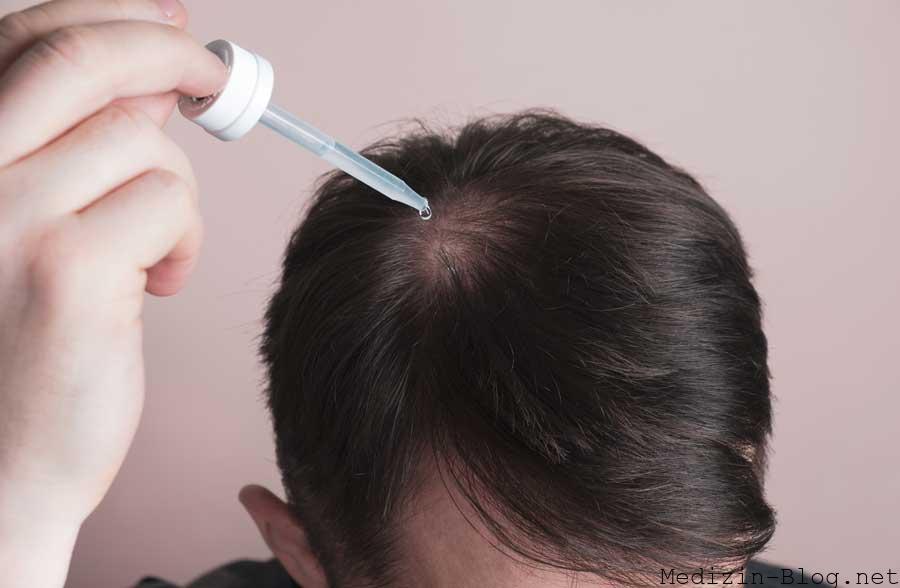 Minoxidil