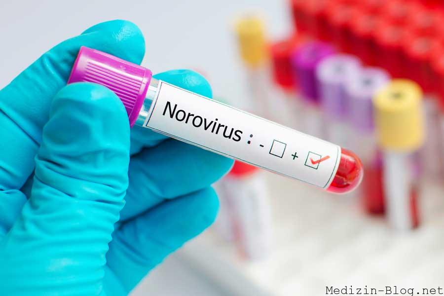 norovirus-welle