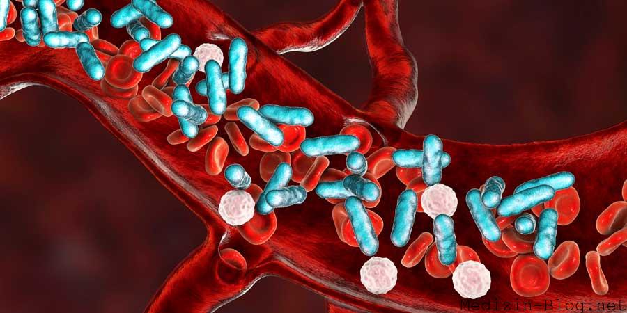 sepsis-bakterien