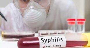 syphilis-ausbruch