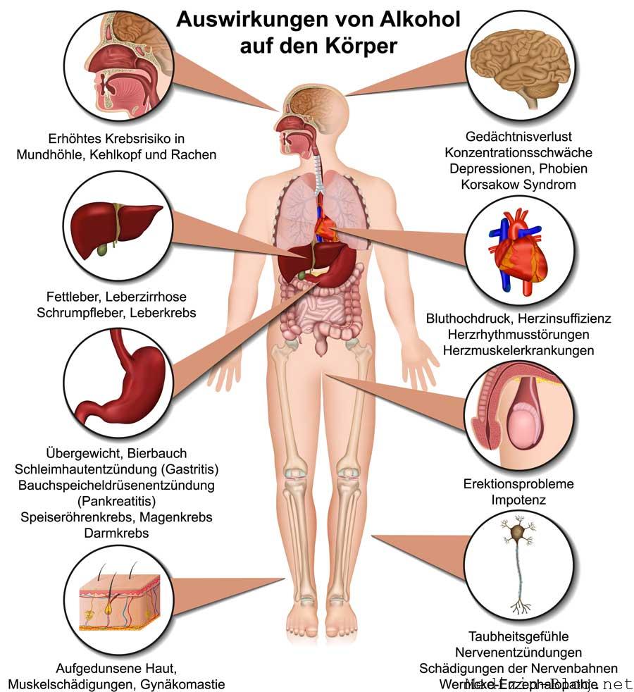 Auswirkungen von Alkohol auf den Körper