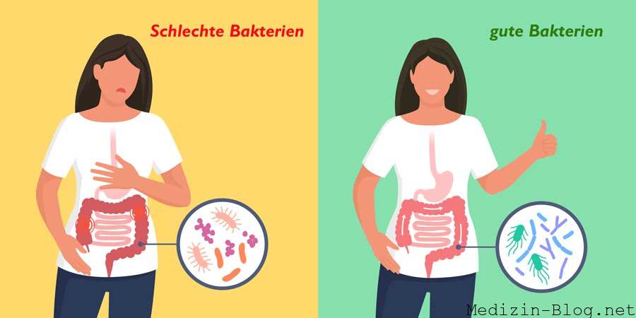 gute-bakterien--schlechte-bakterien-darm