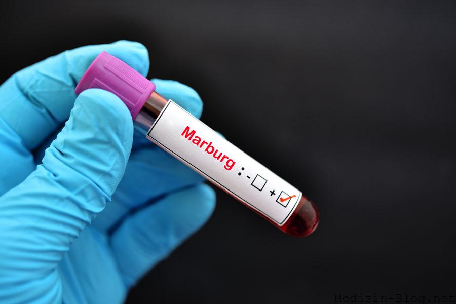 marburg-virus