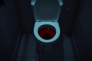 Blut im Stuhl