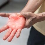 Polyneuropathie