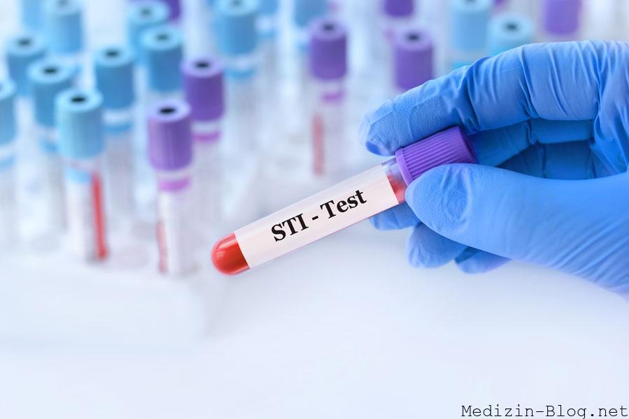 sti-test