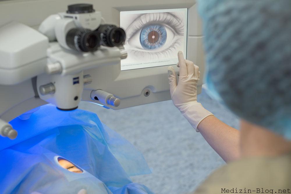augen-lasern