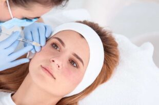 dermafiller-behandlung