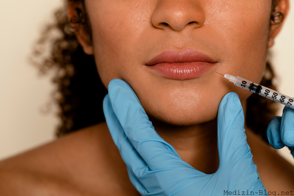 dermafiller-gesicht
